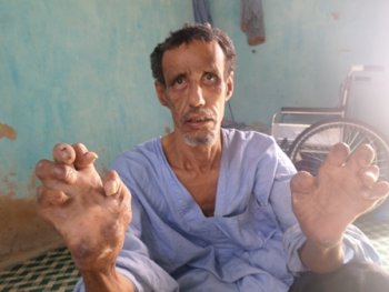 المواطن الموريتاني: عثمان ولد تارو