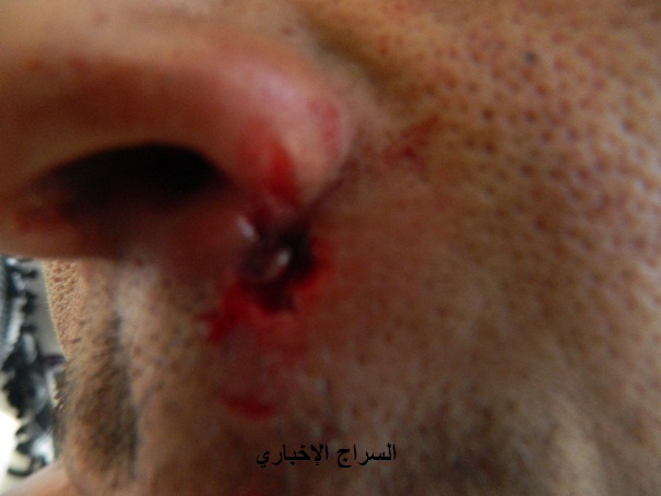 الشرطة اصبحت توجل فوهة المدفع نول وجوه الطلاب