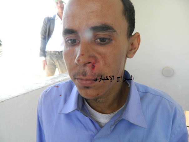 احد الطلاب الغاضبين اصيب على فيه اصابة خطيرة