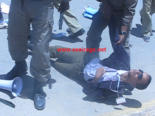 الصحة ولد جعفر تعرض للضرب والركل من الشرطة