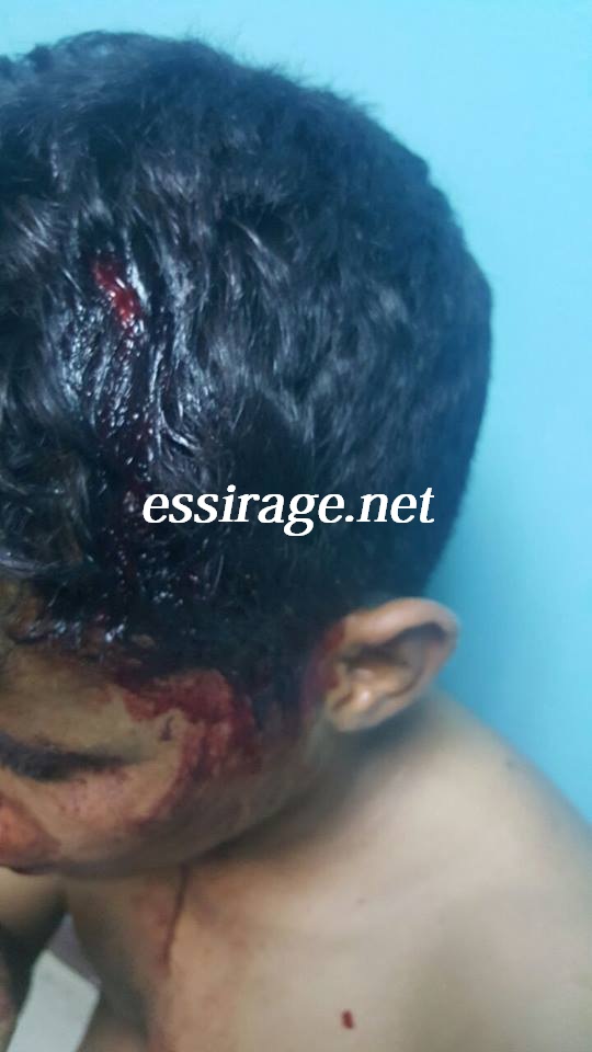 صورة من الشاب بعد الاعتداء عليه