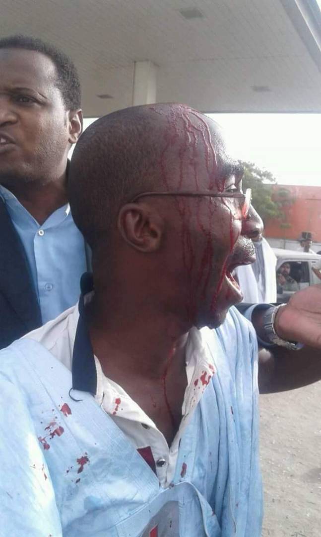 أحد الجرحى إثر تعرضه لجراح خلال تفريق الشرطة للمتظاهرين