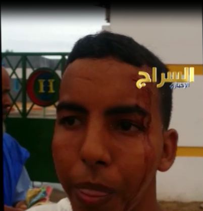 أحد الجرحي أمام مستشفي الشيخ زايد 